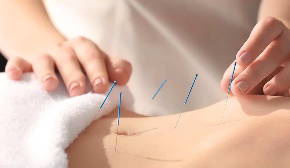 acupunctura ajuta la slabit